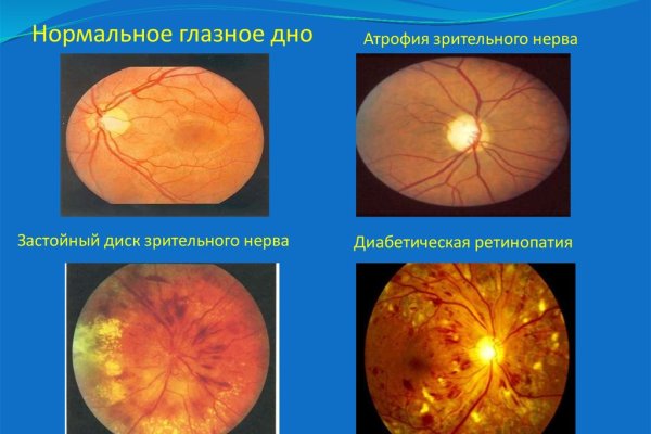 Кракен как зайти на сайт